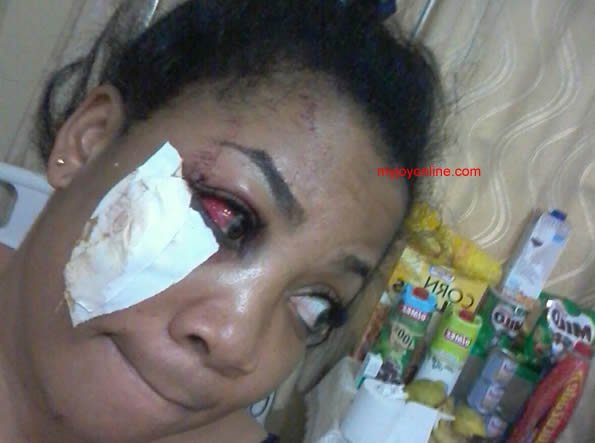 Vicky Zugah in the hospital